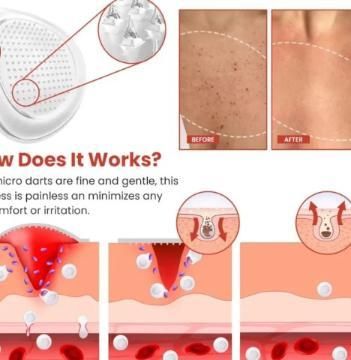 Skin Tag Remover Patch